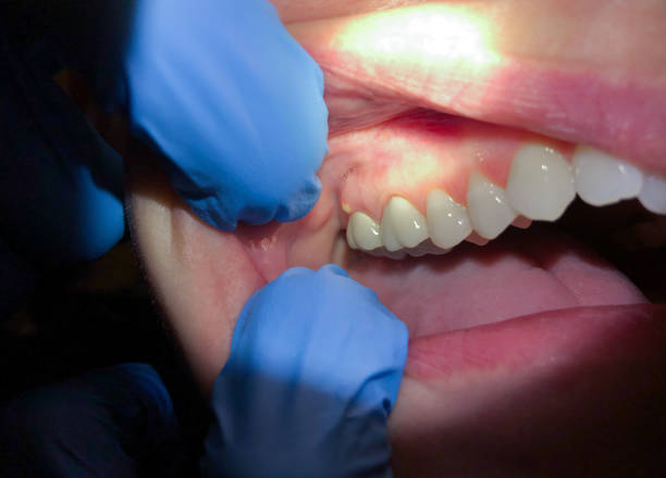 Best Urgent Tooth Repair  in Onset, MA