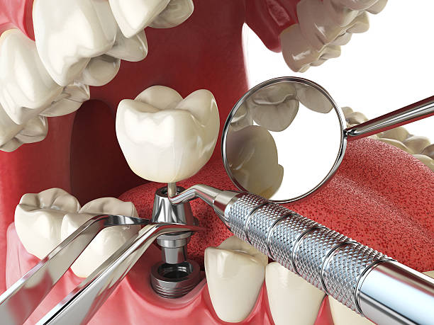 Dentist for Dental Trauma in MA